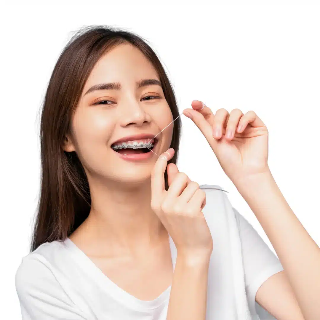 Clear braces vs metal (6)