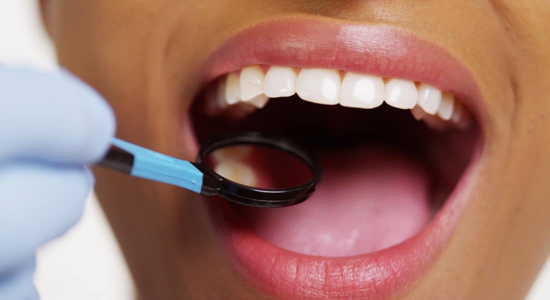 Holistic dentist in belle chasse, la