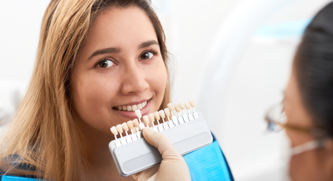 Veneers