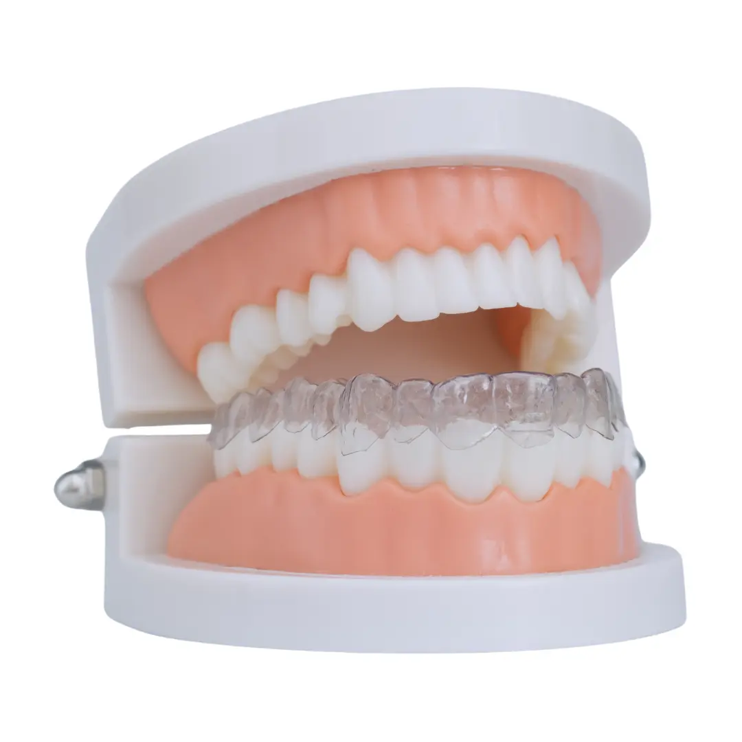 Why choose clear aligners for kids